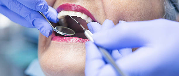 Best Emergency Dentist for Lost Fillings or Crowns in Southwest Greensburg, PA